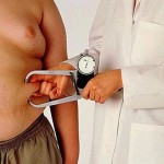 Bariatric-Surgery-for-obesity